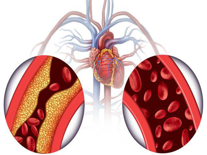 Betaine for the treatment of liver diseases